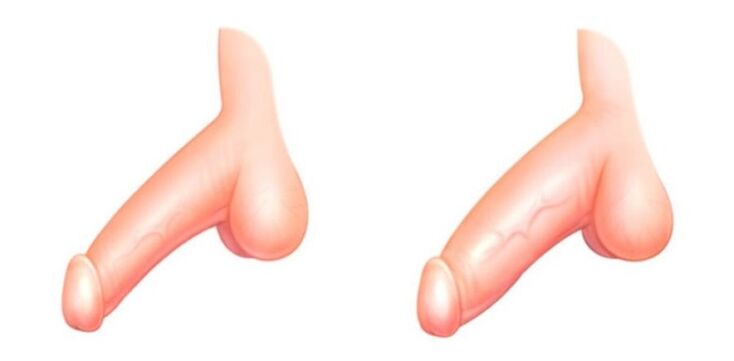 Members before and after addition